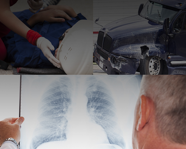 Injured person with helmet, damaged vehicle, and medical chest X-ray.